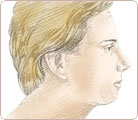 Chin & Cheek Augmentation 1