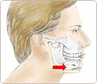 Chin & Cheek Augmentation 2