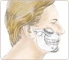 Chin & Cheek Augmentation 3