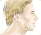 Chin & Cheek Augmentation 4