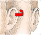 Otoplasty Surgery Procedures 3