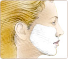 Skin Resurfacing 1