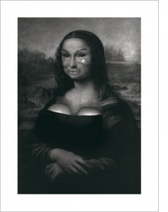 Plastic Surgery Gone Bad