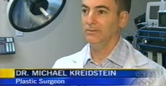 CTV Interview with Dr. Michael Kreidstein